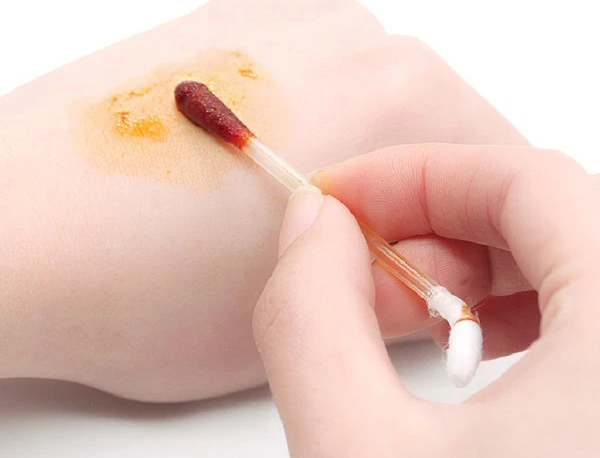 酒精消毒和碘伏消毒：分別適用在那些場景中使用，如何區(qū)別呢？